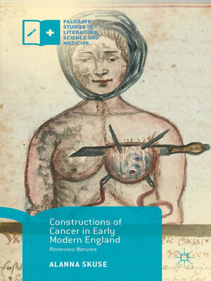 cover image of Constructions of Cancer in Early Modern England